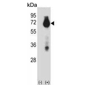 Western blot testing of 1) non-transfected and 2) transfected 293 cell lysate with BIRC3 antibody. P