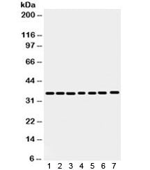 Annexin A3 Antibody