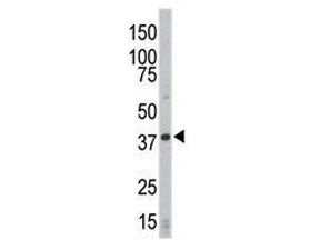CDK4 Antibody
