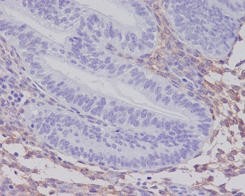 Platelet Derived Growth Factor Receptor beta Antibody / PDGFRB