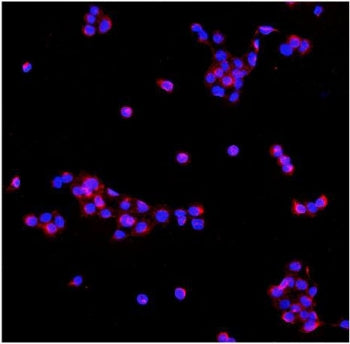 Immunofluorescent staining of FFPE human A431 cells with PDE6 beta antibody (red) and DAPI nuclear s