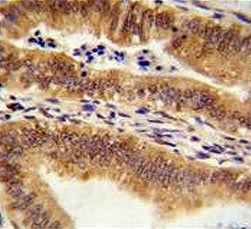MEAK7 Antibody / TLDC1 / KIAA1609