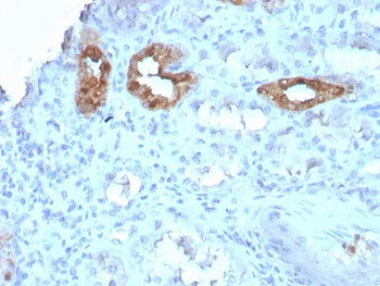 IHC staining of FFPE human kidney with CALB1 antibody. HIER: boil tissue sections in pH 9 10mM Tris 