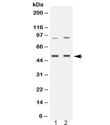 Western blot testing of 1) rat brain and 2) human HeLa lysate with MAP3K8 antibody at 0.5ug/ml. Expe