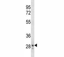 SNAI3 Antibody