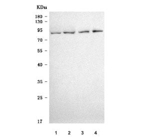 SCIN Antibody / Scinderin