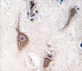 PGP9.5 Antibody