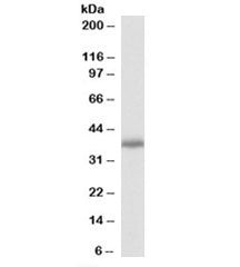 PDLIM2 Antibody