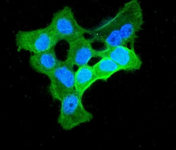 Alpha Enolase Antibody / ENO1 / Enolase 1