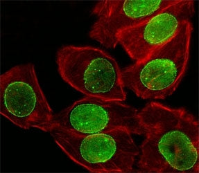 Fluorescent image of A549 cell stained with SUMO-1 antibody at 1:25. SUMO1 immunoreactivity is local