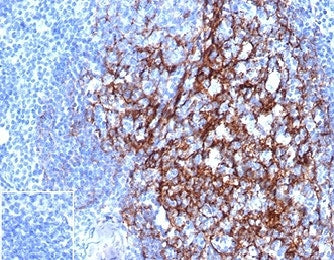 IHC staining of FFPE human tonsil tissue with CD23 antibody (clone FCER2/4918) at 2ug/ml in PBS for 