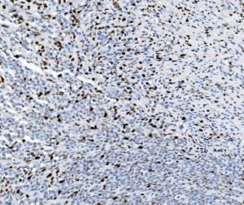 SAMHD1 Antibody