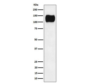 Western blot testing of human Ramos cell lysate with ICAM3 antibody. Observed molecular weight: 60~1
