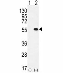 PRMT2 Antibody