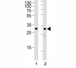 SNAIL Antibody (SNAI1)