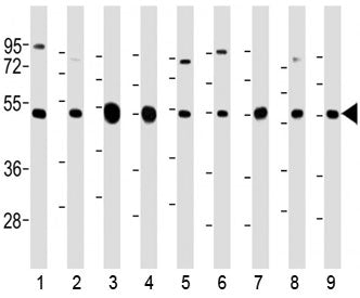 Tubulin beta 2A Antibody / TUBB2A