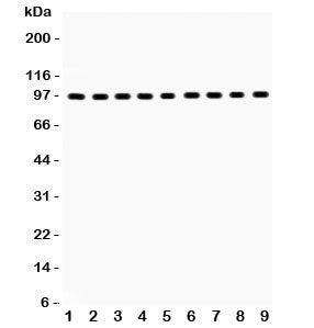 GR Antibody