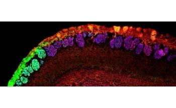 NCAM2 Antibody