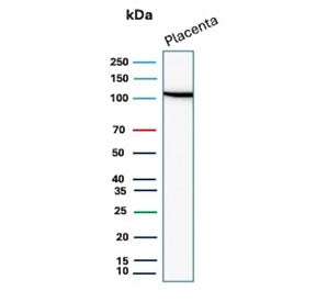 Western blot testing of human placental tissue lysate with recombinant E-Cadherin antibody. Expected