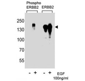Phospho-ErbB2 Antibody (pY1222)