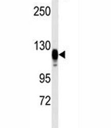 EGF Receptor Antibody
