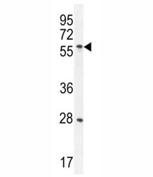 DLK antibody western blot analysis in CEM lysate. Observed molecular weight 41~60 kDa depending on g