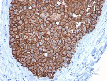 HER2 Antibody / ErbB2
