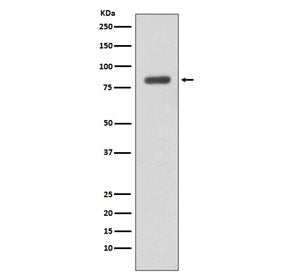 IKK beta Antibody / IKBKB
