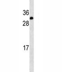IGF2 antibody western blot analysis in A549 lysate. Predicted molecular weight: 20, 20, 26 kDa (isof