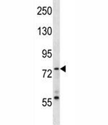 Syk Antibody