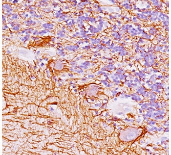 IHC testing of FFPE human cerebellum with Neurofilament antibody (clone NF421).