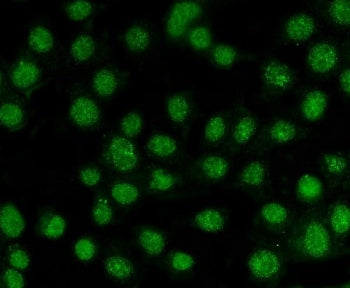 Immunofluorescent staining of FFPE human MCF7 cells with AKT1/2/3 antibody. HIER: steam section in p