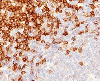 CD5 Antibody