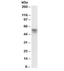 Serpina6 Antibody
