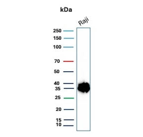Western blot testing of human Raji cell lysate with CD74 antibody. Expected molecular weight: 33-43 