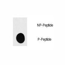 p70 S6 Kinase alpha Antibody (RPS6KB1) (phospho-S418)