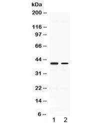 Western blot testing of 1) rat kidney and 2) human A431 lysate with ABHD5 antibody at 0.5ug/ml. Pred