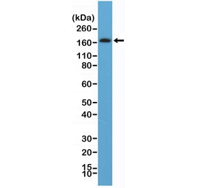 Platelet Derived Growth Factor Receptor beta Antibody / PDGFRB (C-Terminal)