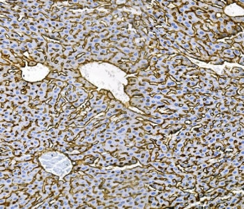 Cd81 Antibody