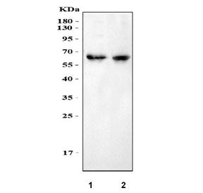 Western blot testing of 1) rat brain and 2) mouse brain with MPP2 antibody at 0.5ug/ml. Predicted mo