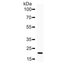 IL6 Antibody