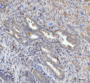 PDLIM7 Antibody