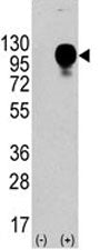 LAMP2 Antibody (CD107b)