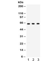 Western blot testing of 1) rat spleen, 2) mouse testis, 3) human SW620 lysate with Chk2 antibody. Ex