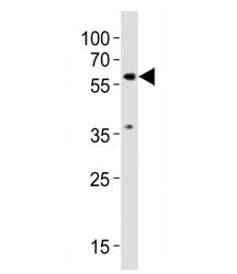 SMAD2 Antibody