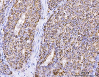 ATP5B Antibody / ATP5F1B / ATP synthase subunit beta