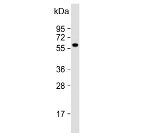 Western blot testing of human Raji cell lysate with FGR antibody. Predicted molecular weight: ~59 kD