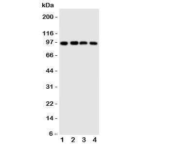 Western blot testing of SIDT1 antibody and Lane 1: HeLa; 2: COLO320; 3: SW620; 4: HT1080 cell lysate