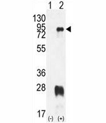 PRMT7 Antibody