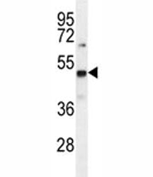 PRMT1 Antibody